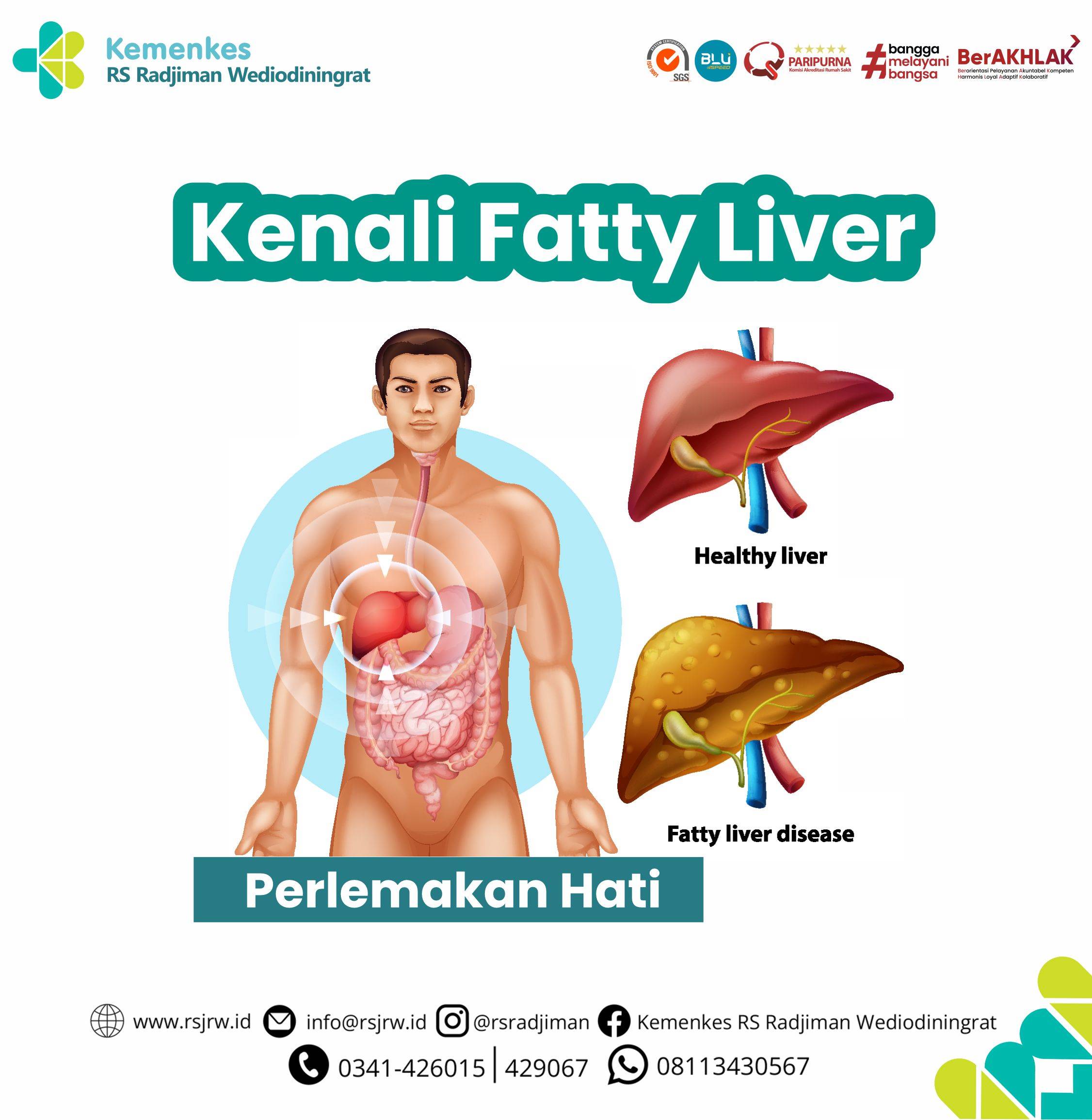 Kenali Gejala Fatty Liver